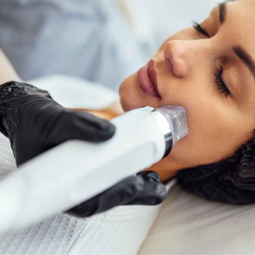 Buy 2 Get 1 Free RF Microneedling - Labor Day Promotion