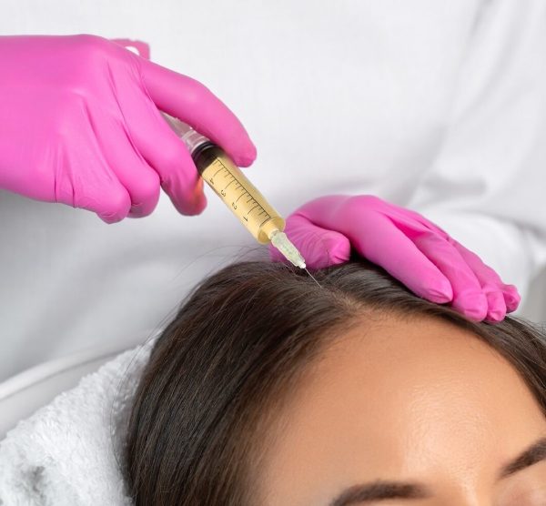 PRP for hair growth/hair loss/hair restoration – 1 procedure