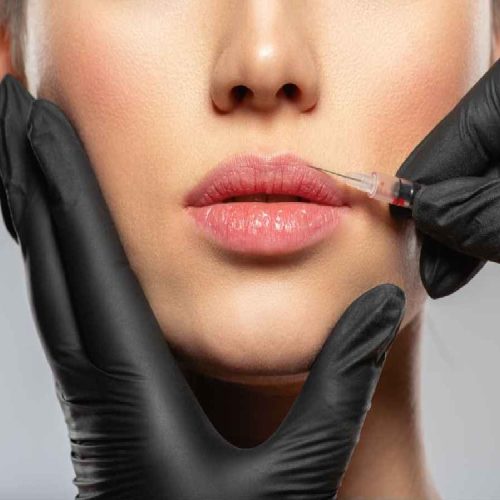 Botox – 1 unit