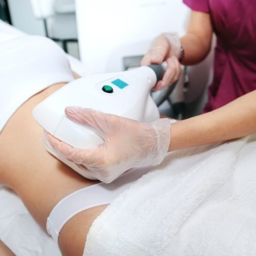 Coolsculpting. Large area – 1 session