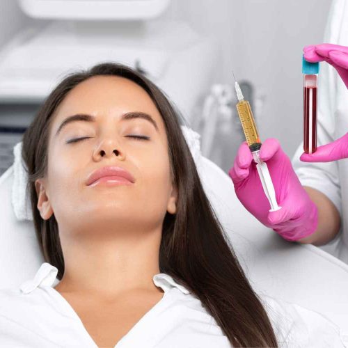 PRP Facelift