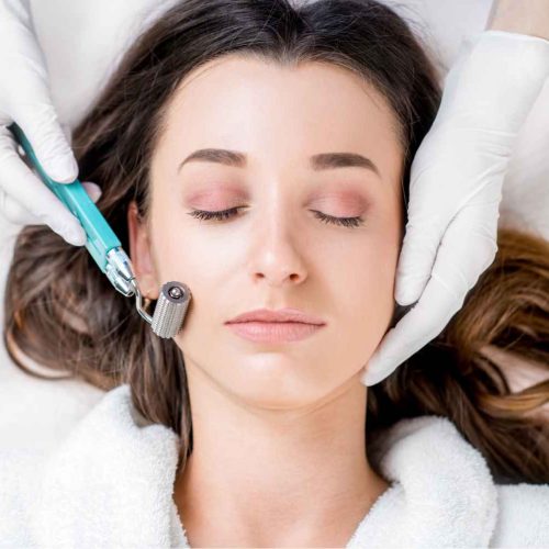 RF Microneedling – 1 session