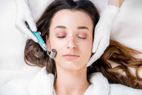 SmoothGlo( IPL+RF microneedling)