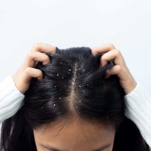 Scalp – 1 session