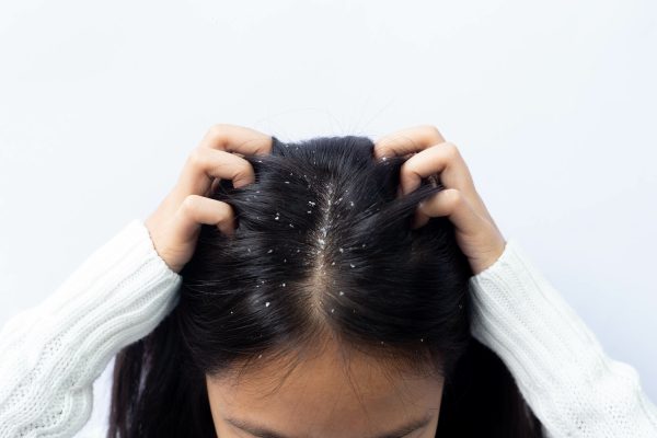Scalp – 1 session