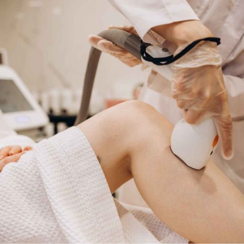 The Lumenis® M22™ IPL – 1 session