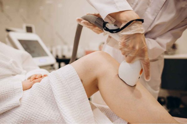 The Lumenis® M22™ IPL – 1 session