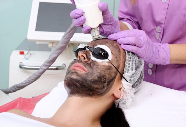 Carbon Laser Facial – 6 sessions