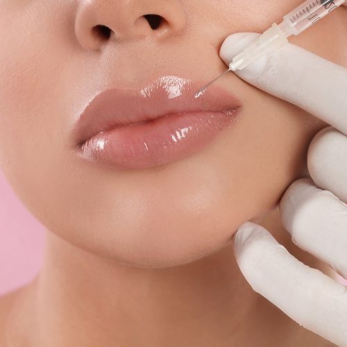 RADIESSE® Dermal Filler – 1 syringe