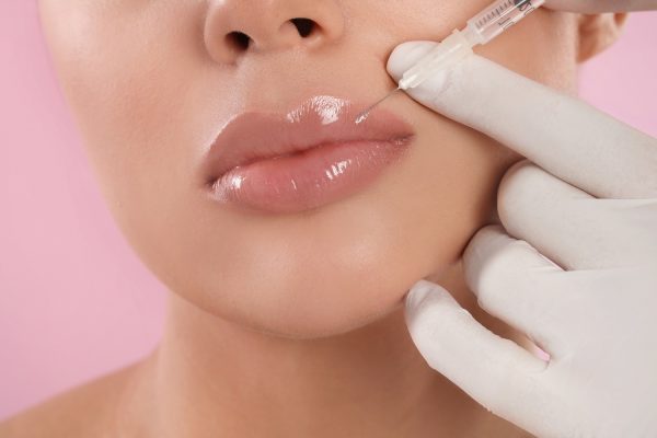 Lip enhancements – 1 session
