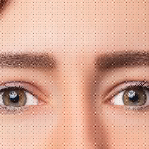 Ultherapy – Full Eye