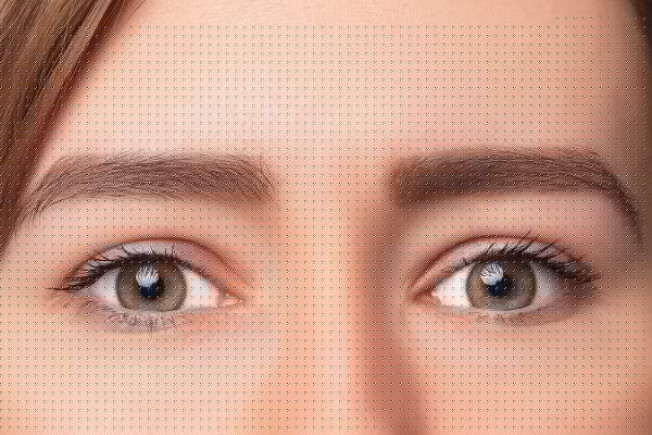 Ultherapy – Full Eye