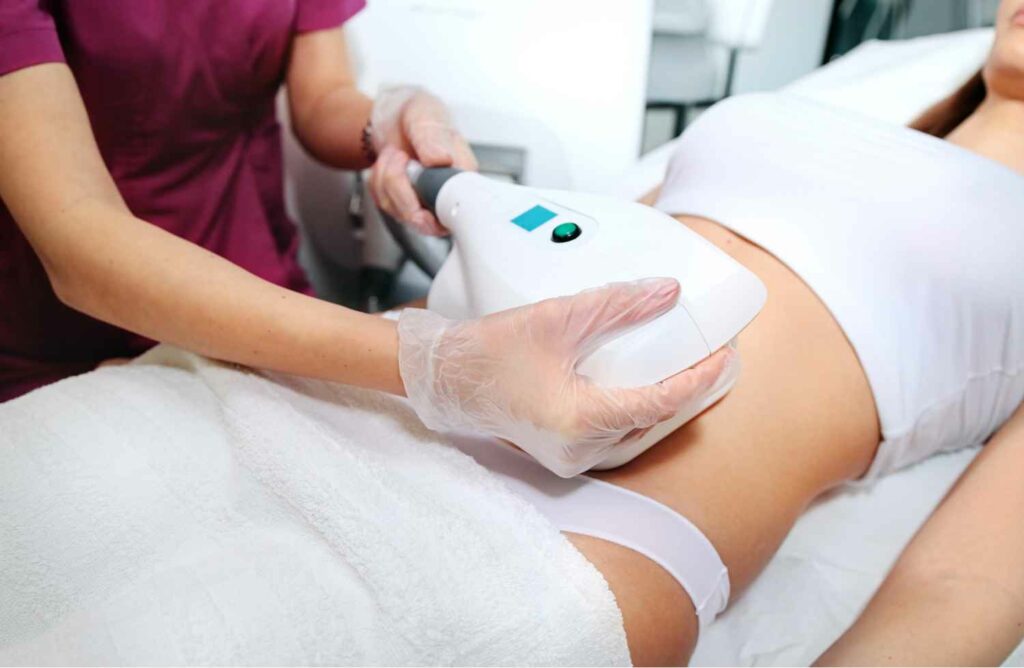 CoolSculpting-Elite-sunny-isles-Non-Surgical-Fat-Removal-Treatment