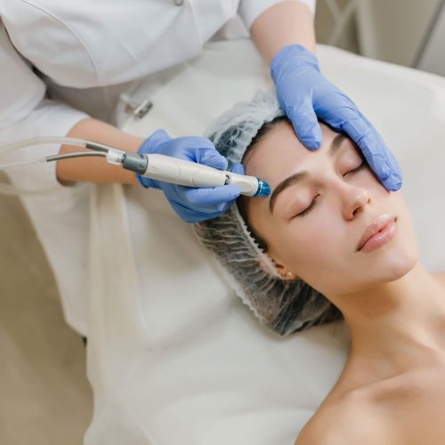 Secret RF Microneedling