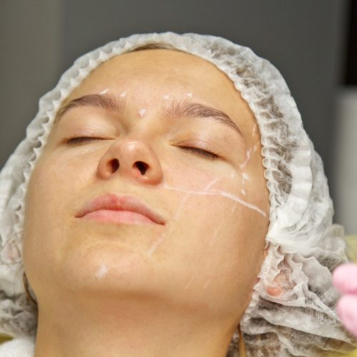 Kybella - Per Vial